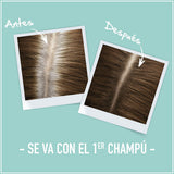 Spray Correcteur de Racines et Cheveux Blancs L'Oreal Make Up Magic Retouch 4-Blond 100 ml